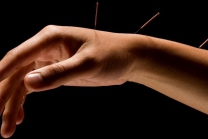 Acupuncture - Rendez-vous découverte