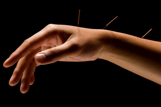 Acupuncture - Rendez-vous découverte  