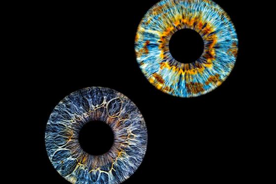 Shooting d'iris en couple - 40x40cm, impression sur verre, pour 2 personnes   