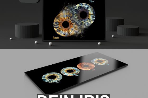 Shooting d'iris en couple - 40x40cm, impression sur verre, pour 2 personnes  1 