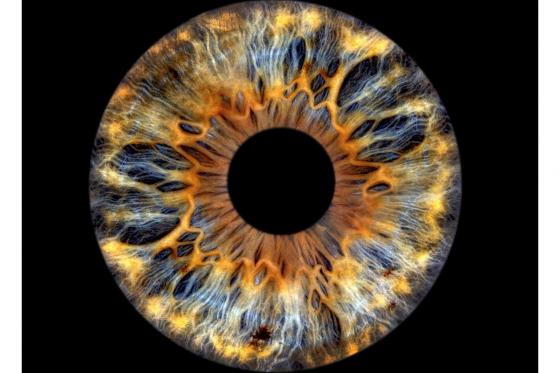 Shooting d'iris en couple - 40x40cm, impression sur verre, pour 2 personnes  2 