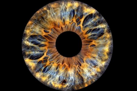 Iris Fotografie - 30x30cm auf Acrylglas, für eine Person  