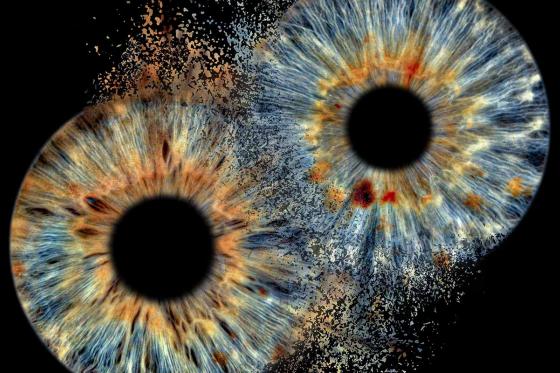 Iris Paar Fotografie - 40x40cm, auf Acrylglas mit Explosions Effekt  