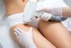 Épilation définitive au laser diode - 2 séances bikini simple pour 1 personne 3